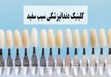 بهترین رنگ کامپوزیت دندان بر اساس تجربه